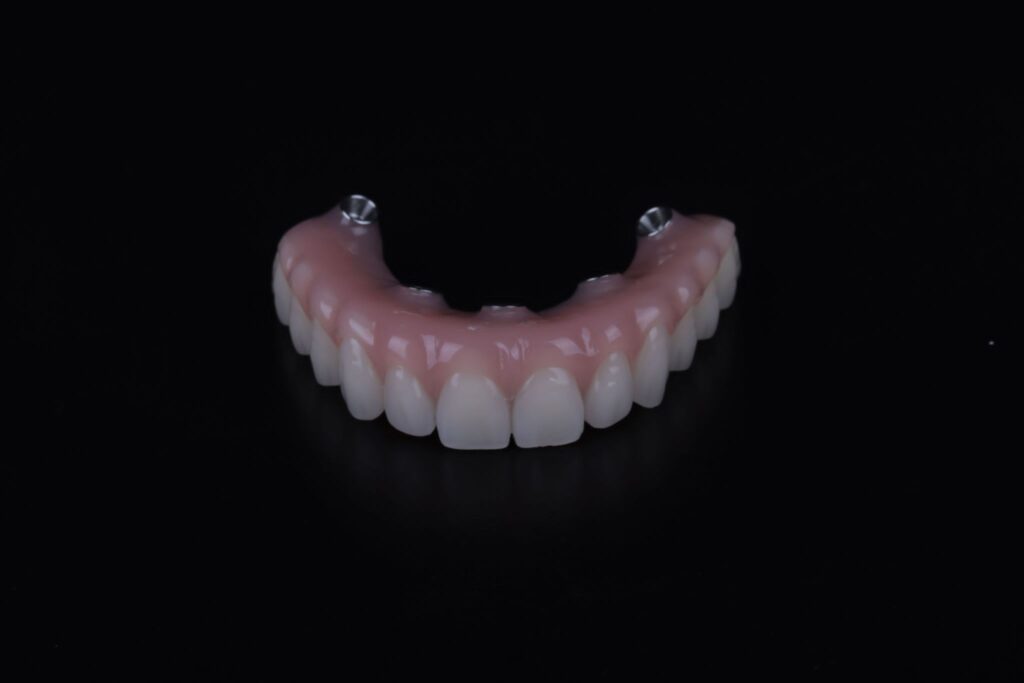 All-on-x ülemine hambakaar